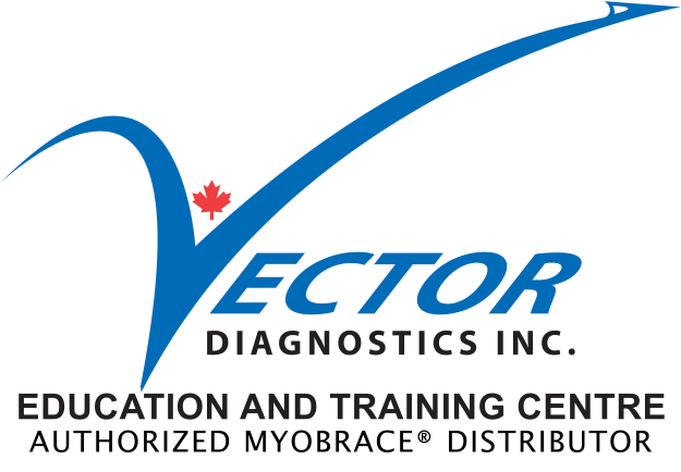 Vector